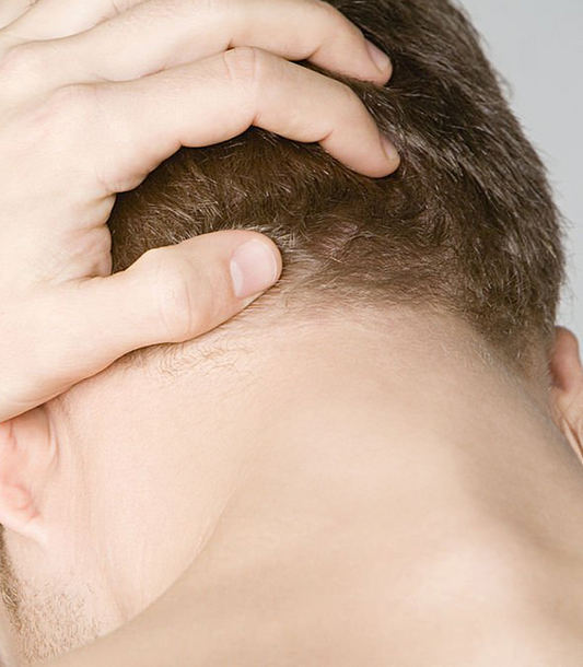 Why Your Scalp Gets Itchy - and What You Can Do About It
